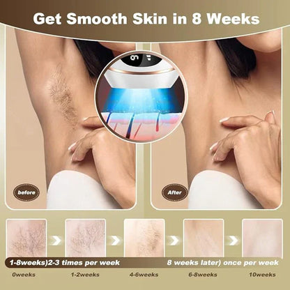 Silky Skin Forever: IPL Hair Removal Flashes with No Pain